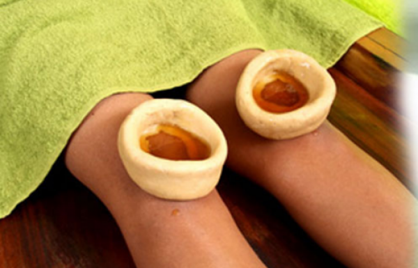 Ayurvedic procedure in which a concoction is made of gram flour and is placed around the knee. The ring is sealed to prevent leakage and warm medicated oil is poured in the ring and kept warm for 30 minutes by replacing it with warmer oil. Warm medicated oil is poured on the knee to reduce the dryness, stiffness and the pain.